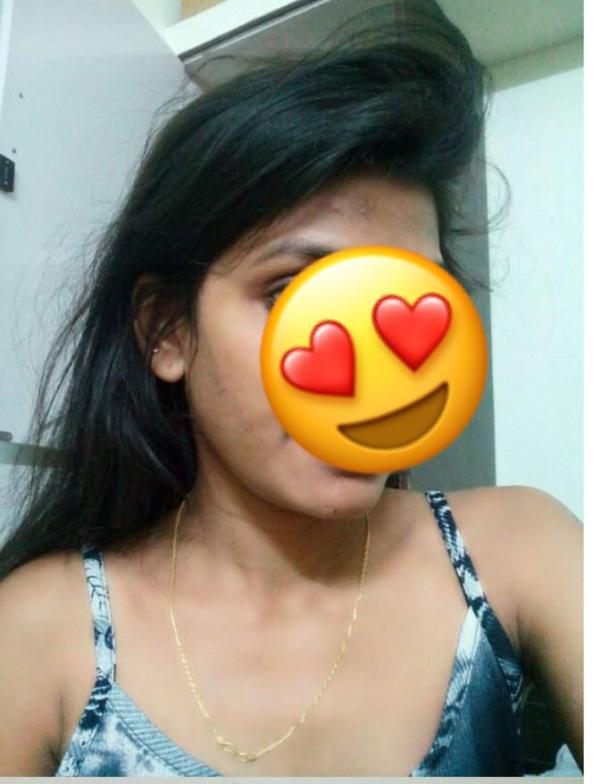 67bd3a5e91190TBZ1hmoTnk1740454494